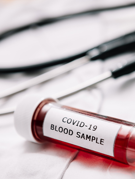 SEROLOGIC-ANTIBODY-TESTING-FOR-COVID-19 SEROLOGIC-ANTIBODY-TESTING-FOR-COVID-19